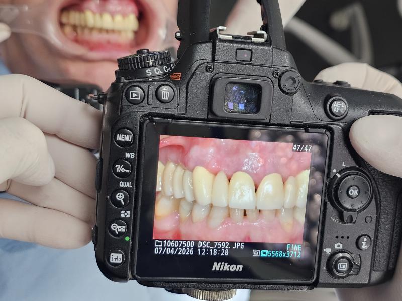 Trapano & macchina fotografica